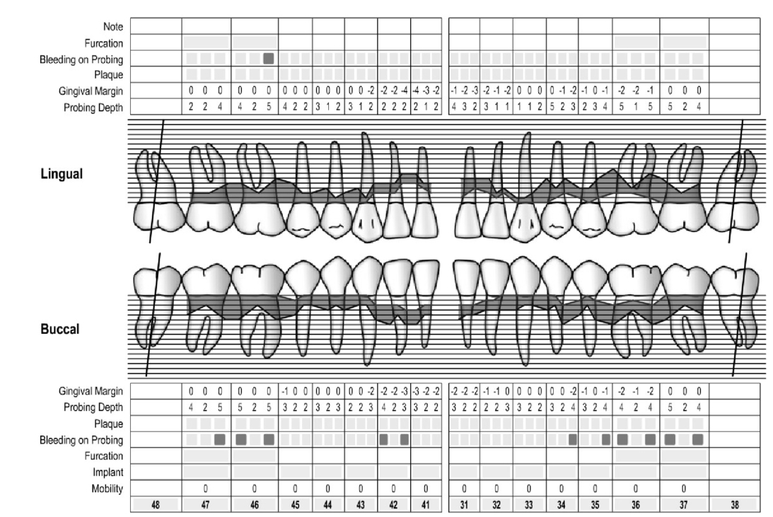 Downloadable Perio Chart