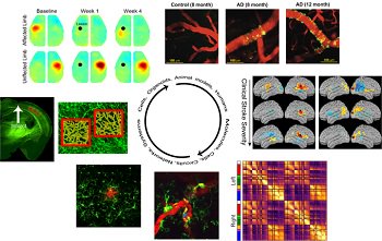 Understanding brain disease with live imaging